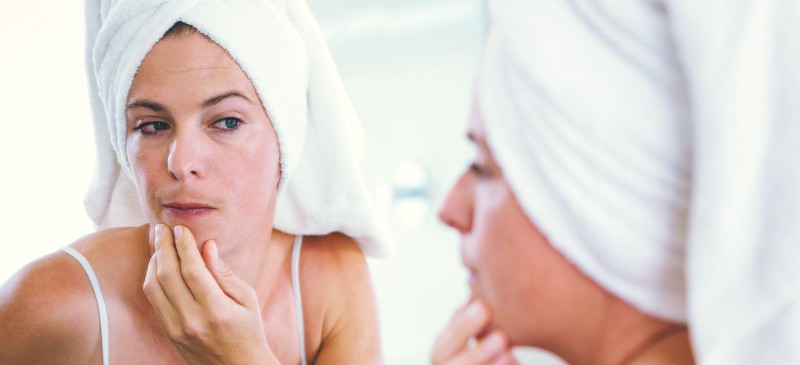 What Are The Ways To Deal With Hirsutism?